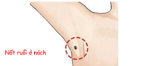 Cơ thể có 5 nốt ruồi này, khó khăn chỉ là tạm thời, phú quý sang giàu là mãi mãi