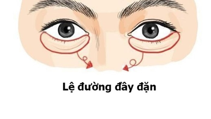 Phụ nữ sở hữu phúc tướng này, chồng nào cưới được phước đức ba đời, đại cát, đại lợi