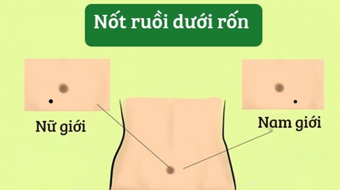 Sở hữu 3 nốt ruồi này, bất kể nam nữ, sự nghiệp tài vận đều thăng hoa